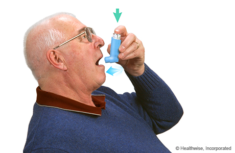 Using a Metered-Dose Inhaler Without a Spacer | University of Michigan ...