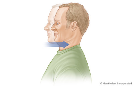 Dorsal Glide | University of Michigan Health System