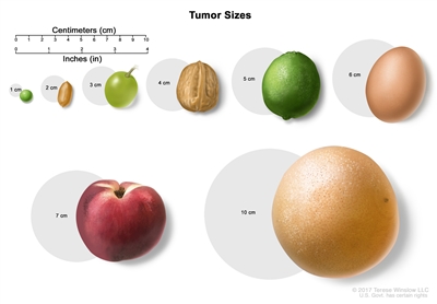 Vulvar Cancer Treatment (PDQ®): Treatment - Patient Information [NCI ...