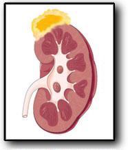 the adrenal gland is to the kidney